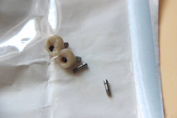 three components of a dental implant